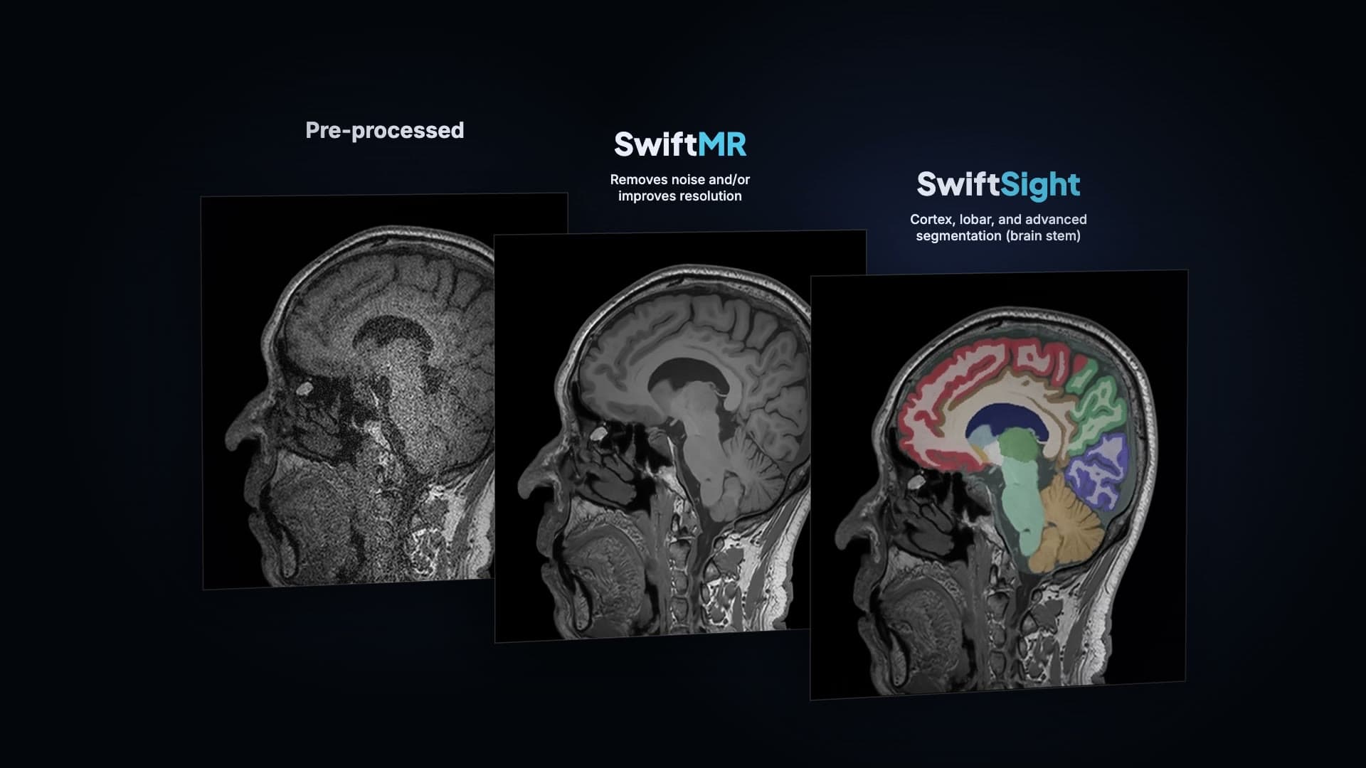 에어스메디컬 — 회사 공식 CDN(wp-content) 소스이며 MRI AI 플랫폼 제품을 대표하는 메인 히어로 이미지로 기사 서사와 시각적으로 부합함